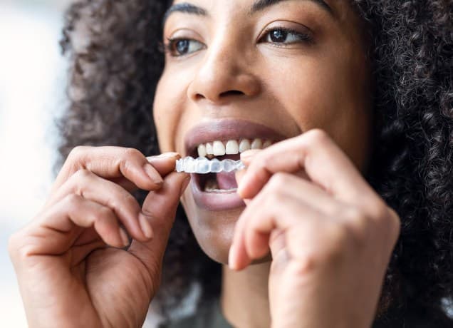 how long does invisalign take universal: woman putting a clear Invisalign tray in mouth