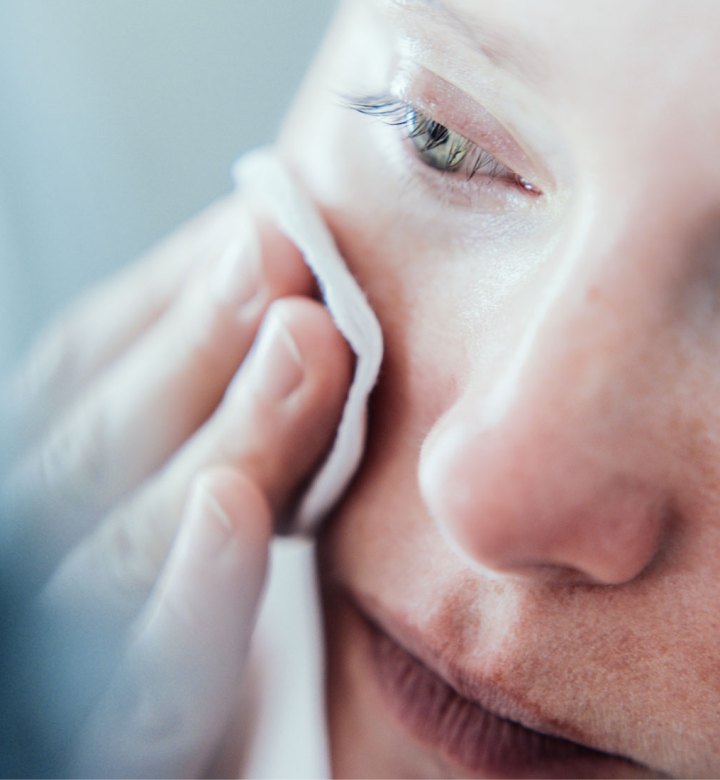 10 Products for Sensitive Skin - A close up shot of a pale white woman with freckles wiping her face with a cotton round. She is looking in a mirror.