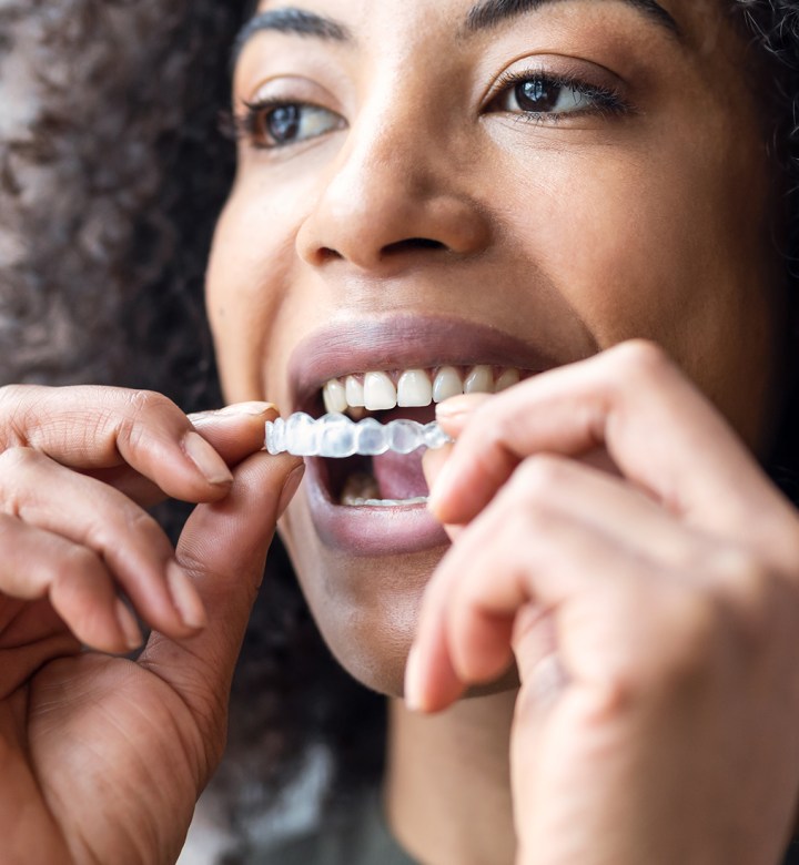 how long does invisalign take universal: woman putting a clear Invisalign tray in mouth